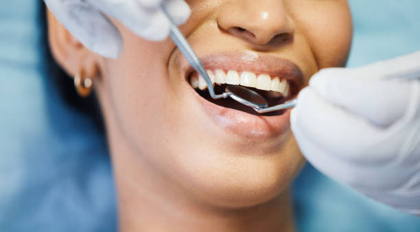 Best Emergency Wisdom Tooth Extraction in Lost Hills, CA