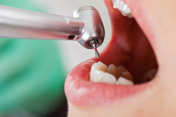 Best Emergency Treatment for Oral Infections in Lost Hills, CA